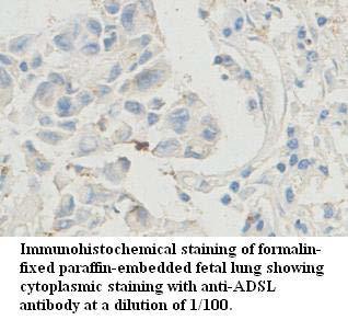 ADSL / Adenylosuccinate Lyase Antibody