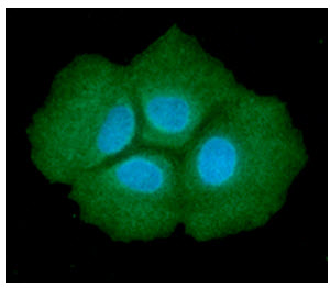 ADSL / Adenylosuccinate Lyase Antibody - ICC/IF analysis of ADSL in Hep3B cells line, stained with DAPI (Blue) for nucleus staining and monoclonal anti-human ADSL antibody (1:100) with goat anti-mouse IgG-Alexa fluor 488 conjugate (Green).