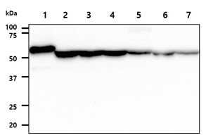 ADSL / Adenylosuccinate Lyase Antibody - The Recombinant Human ADSL (20ng) and Cell lysates (40ug) were resolved by SDS-PAGE, transferred to PVDF membrane and probed with anti-human ADSL antibody (1:1000). Proteins were visualized using a goat anti-mouse secondary antibody conjugated to HRP and an ECL detection system. Lane 1. : Recombinant Protein Lane 2. : HeLa cell lysate Lane 3. : 293T cell lysate Lane 4. : Jurkat cell lysate Lane 5. : HepG2 cell lysate Lane 6. : A549 cell lysate Lane 7. : MCF7 cell lysate