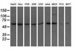 ADSL / Adenylosuccinate Lyase Antibody - Western blot analysis of extracts (35ug) from 9 different cell lines by using anti-ADSL monoclonal antibody.