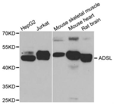 ADSL / Adenylosuccinate Lyase Antibody - Western blot analysis of extracts of various cell lines.