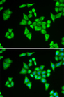 ADSL / Adenylosuccinate Lyase Antibody - Immunofluorescence analysis of HeLa cells.