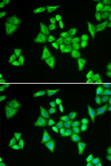ADSL / Adenylosuccinate Lyase Antibody - Immunofluorescence analysis of HeLa cells.