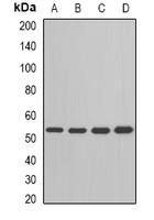 ADSL / Adenylosuccinate Lyase Antibody - Western blot analysis of ADSL expression in HepG2 (A); Jurkat (B); mouse heart (C); rat brain (D) whole cell lysates.