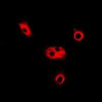 ADSL / Adenylosuccinate Lyase Antibody - Immunofluorescent analysis of ADSL staining in HeLa cells. Formalin-fixed cells were permeabilized with 0.1% Triton X-100 in TBS for 5-10 minutes and blocked with 3% BSA-PBS for 30 minutes at room temperature. Cells were probed with the primary antibody in 3% BSA-PBS and incubated overnight at 4 deg C in a humidified chamber. Cells were washed with PBST and incubated with a DyLight 594-conjugated secondary antibody (red) in PBS at room temperature in the dark.