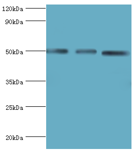 ADSS Antibody - Western blot. All lanes: Adenylosuccinate synthetase isozyme 2 antibody at 12 ug/ml. Lane 1: mouse skeletal muscle tissue. Lane 2: HepG2 whole cell lysate. Lane 3: K562 whole cell lysate. secondary Goat polyclonal to rabbit at 1:10000 dilution. Predicted band size: 50 kDa. Observed band size: 50 kDa.