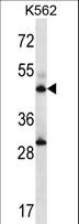 ADSS Antibody - ADSS Antibody western blot of K562 cell line lysates (35 ug/lane). The ADSS antibody detected the ADSS protein (arrow).