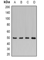 ADSS Antibody - Western blot analysis of ADSS expression in BT474 (A); mouse lung (B); mouse brain (C); rat kidney (D) whole cell lysates.