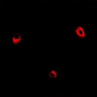 ADSS Antibody - Immunofluorescent analysis of ADSS staining in HeLa cells. Formalin-fixed cells were permeabilized with 0.1% Triton X-100 in TBS for 5-10 minutes and blocked with 3% BSA-PBS for 30 minutes at room temperature. Cells were probed with the primary antibody in 3% BSA-PBS and incubated overnight at 4 deg C in a humidified chamber. Cells were washed with PBST and incubated with a DyLight 594-conjugated secondary antibody (red) in PBS at room temperature in the dark.