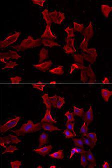 ADSS Antibody - Immunofluorescence analysis of HeLa cells using ADSS antibody. Blue: DAPI for nuclear staining.