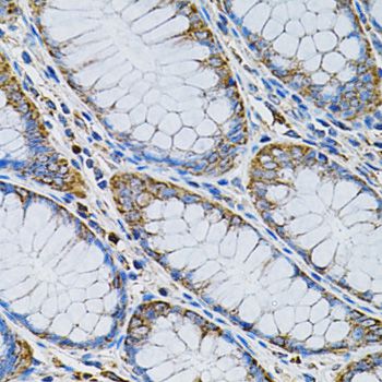 ADSS Antibody - Immunohistochemistry of paraffin-embedded human colon using ADSS antibody at dilution of 1:100 (40x lens).