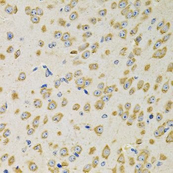 ADSS Antibody - Immunohistochemistry of paraffin-embedded mouse brain using ADSS antibody at dilution of 1:100 (40x lens).