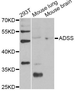 ADSS Antibody - Western blot analysis of extracts of various cell lines, using ADSS Antibody at 1:1000 dilution. The secondary antibody used was an HRP Goat Anti-Rabbit IgG (H+L) at 1:10000 dilution. Lysates were loaded 25ug per lane and 3% nonfat dry milk in TBST was used for blocking. An ECL Kit was used for detection and the exposure time was 90s.