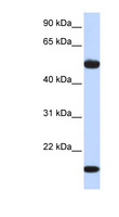 ADSSL1 Antibody - ADSSL1 antibody Western blot of Fetal Muscle lysate. This image was taken for the unconjugated form of this product. Other forms have not been tested.