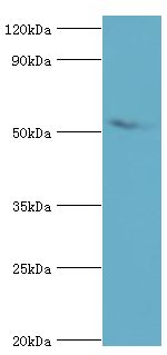 AEBP2 Antibody - Western blot. All lanes: Zinc finger protein AEBP2 antibody at 4 ug/ml+HeLa whole cell lysate. Secondary antibody: Goat polyclonal to rabbit at 1:10000 dilution. Predicted band size: 54 kDa. Observed band size: 54 kDa Immunohistochemistry.