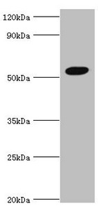 AEBP2 Antibody - Western blot All lanes: Zinc finger protein AEBP2 antibody at 4µg/ml + Hela whole cell lysate Secondary Goat polyclonal to rabbit IgG at 1/10000 dilution Predicted band size: 55, 53, 34 kDa Observed band size: 55 kDa