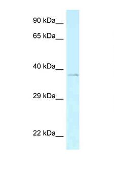 AEBP2 Antibody - AEBP2 antibody Western blot of Mouse Spleen lysate. Antibody concentration 1 ug/ml.  This image was taken for the unconjugated form of this product. Other forms have not been tested.