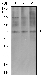 AEBP2 Antibody - Western blot analysis using AEBP2 mouse mAb against COS7 (1), HepG2 (2), and SK-MES-1 (3) cell lysate.