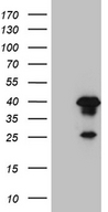 AEBP2 Antibody - HEK293T cells were transfected with the pCMV6-ENTRY control. (Left lane) or pCMV6-ENTRY AEBP2. (Right lane) cDNA for 48 hrs and lysed. Equivalent amounts of cell lysates. (5 ug per lane) were separated by SDS-PAGE and immunoblotted with anti-AEBP2. (1:2000)