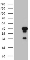 AEBP2 Antibody - HEK293T cells were transfected with the pCMV6-ENTRY control. (Left lane) or pCMV6-ENTRY AEBP2. (Right lane) cDNA for 48 hrs and lysed