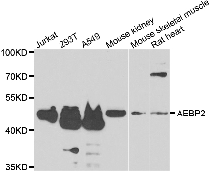AEBP2 Antibody - Western blot analysis of extracts of various cell lines.