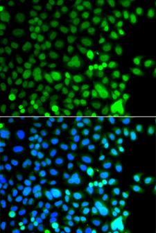 AEBP2 Antibody - Immunofluorescence analysis of A549 cells.