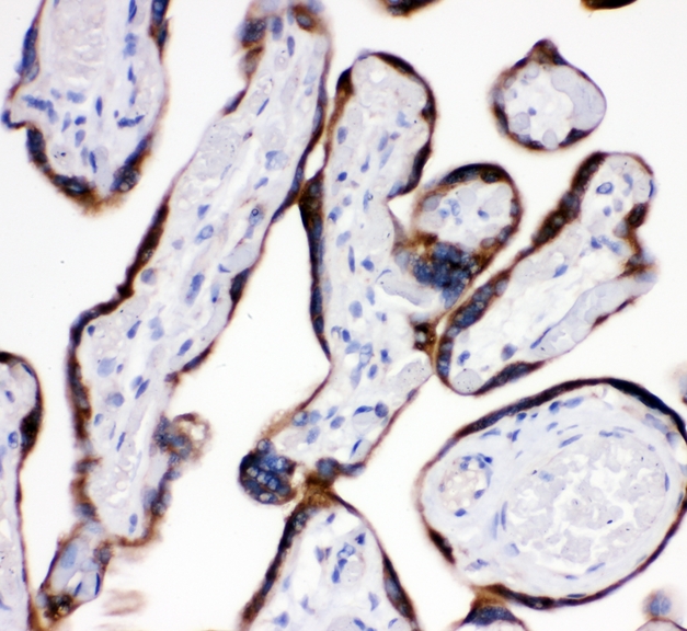 AEBP2 Antibody - IHC analysis of AEBP2 using anti-AEBP2 antibody. AEBP2 was detected in paraffin-embedded section of human placenta tissues. Heat mediated antigen retrieval was performed in citrate buffer (pH6, epitope retrieval solution) for 20 mins. The tissue section was blocked with 10% goat serum. The tissue section was then incubated with 1µg/ml rabbit anti-AEBP2 Antibody overnight at 4°C. Biotinylated goat anti-rabbit IgG was used as secondary antibody and incubated for 30 minutes at 37°C. The tissue section was developed using Strepavidin-Biotin-Complex (SABC) with DAB as the chromogen.