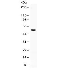 AEBP2 Antibody - Western blot testing of human HL60 cell lysate with AEBP2 antibody at 0.5ug/ml. Expected molecular weight ~55 kDa.