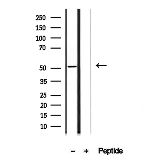 AEBP2 Antibody - Western blot analysis of extracts of human testis tissue using AEBP2 antibody.