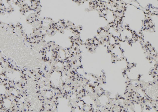 AEBP2 Antibody - 1:100 staining rat lung tissue by IHC-P. The sample was formaldehyde fixed and a heat mediated antigen retrieval step in citrate buffer was performed. The sample was then blocked and incubated with the antibody for 1.5 hours at 22°C. An HRP conjugated goat anti-rabbit antibody was used as the secondary.