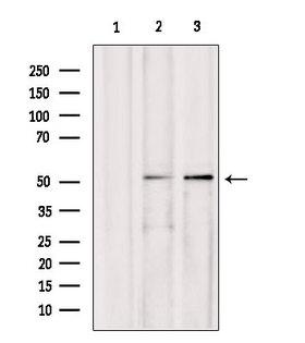 AEBP2 Antibody - Western blot analysis of extracts of various samples using AEBP2 antibody. Lane 1: mouse myeloma treated with blocking peptide. Lane 2: mouse myeloma; Lane 3: B16F10;