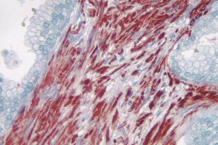 Product -  Prostate: Smooth muscle actin (m), ImmPRESS™ Anti-Mouse Ig Kit, AEC Substrate Kit (red). Hematoxylin QS counterstain (blue). Mounted in VectaMount AQ Mounting Medium.