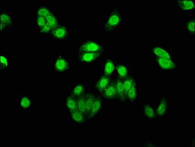 AEN Antibody - Immunofluorescence staining of HepG2 cells with Rabbit anti-human Apoptosis-enhancing nuclease polyclonal Antibody(AEN) at 1:530, counter-stained with DAPI. The cells were fixed in 4% formaldehyde, permeabilized using 0.2% Triton X-100 and blocked in 10% normal Goat Serum. The cells were then incubated with the antibody overnight at 4°C. The secondary antibody was Alexa Fluor 488-congugated AffiniPure Goat Anti-Rabbit IgG(H+L).