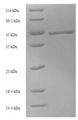 GFP Protein - (Tris-Glycine gel) Discontinuous SDS-PAGE (reduced) with 5% enrichment gel and 15% separation gel.