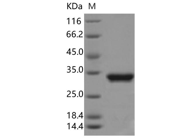 GFP Protein - Recombinant Aequorea victoria GFP Protein (His Tag)-Elabscience