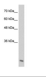 AES / Groucho Antibody - Jurkat Cell Lysate.  This image was taken for the unconjugated form of this product. Other forms have not been tested.