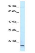 AES / Groucho Antibody - AES / Groucho antibody Western Blot of Mouse Heart. Antibody dilution: 1 ug/ml.  This image was taken for the unconjugated form of this product. Other forms have not been tested.