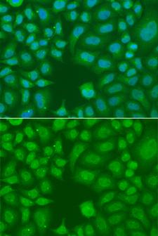 AES / Groucho Antibody - Immunofluorescence analysis of A549 cells.