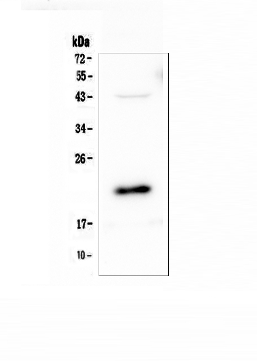 AES / Groucho Antibody - Western blot analysis of AES using anti-AES antibody. Electrophoresis was performed on a 5-20% SDS-PAGE gel at 70V (Stacking gel) / 90V (Resolving gel) for 2-3 hours. The sample well of each lane was loaded with 50ug of sample under reducing conditions. Lane 1: human U-87MG whole cell lysate. After Electrophoresis, proteins were transferred to a Nitrocellulose membrane at 150mA for 50-90 minutes. Blocked the membrane with 5% Non-fat Milk/ TBS for 1.5 hour at RT. The membrane was incubated with rabbit anti-AES antigen affinity purified polyclonal antibody at 0.5 µg/mL overnight at 4°C, then washed with TBS-0.1% Tween 3 times with 5 minutes each and probed with a goat anti-rabbit IgG-HRP secondary antibody at a dilution of 1:10000 for 1.5 hour at RT. The signal is developed using an Enhanced Chemiluminescent detection (ECL) kit with Tanon 5200 system. A specific band was detected for AES at approximately 22KD. The expected band size for AES is at 22KD.