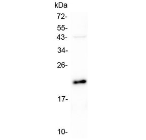 AES / Groucho Antibody - Western blot testing of human U-87 MG lysate with AES antibody at 0.5ug/ml. Predicted molecular weight: ~22 kDa (AES-1), ~29 kDa (AES-2).