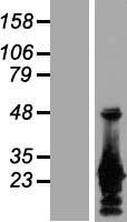 AES / Groucho Protein - Western validation with an anti-DDK antibody * L: Control HEK293 lysate R: Over-expression lysate