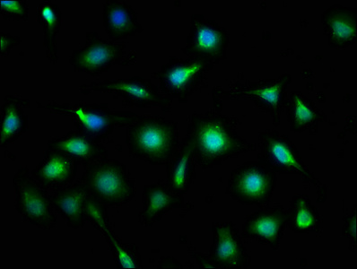 AF1Q / MLLT11 Antibody - Immunofluorescence staining of SH-SY5Y cells with MLLT11 Antibody at 1:133, counter-stained with DAPI. The cells were fixed in 4% formaldehyde, permeabilized using 0.2% Triton X-100 and blocked in 10% normal Goat Serum. The cells were then incubated with the antibody overnight at 4°C. The secondary antibody was Alexa Fluor 488-congugated AffiniPure Goat Anti-Rabbit IgG(H+L).