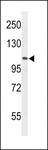 AF5Q31 / AFF4 Antibody - Western blot of AF5q31 Antibody in HL-60 cell line lysates (35 ug/lane). AF5q31 (arrow) was detected using the purified antibody.