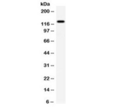 AF5Q31 / AFF4 Antibody - Western blot testing of human COLO320 cell lysate with AFF4 antibody at 0.5ug/ml. Predicted molecular weight ~127/98/39 kDa (isoforms 1/2/3).