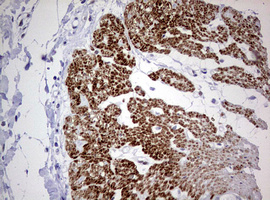 AFAP1 / AFAP Antibody - IHC of paraffin-embedded Human colon tissue using anti-AFAP1 mouse monoclonal antibody. (Heat-induced epitope retrieval by 10mM citric buffer, pH6.0, 120°C for 3min).