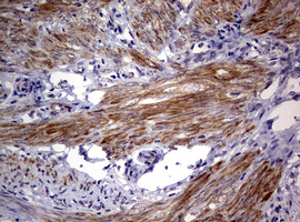 AFAP1 / AFAP Antibody - IHC of paraffin-embedded Human endometrium tissue using anti-AFAP1 mouse monoclonal antibody. (Heat-induced epitope retrieval by 10mM citric buffer, pH6.0, 120°C for 3min).