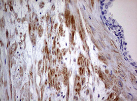 AFAP1 / AFAP Antibody - IHC of paraffin-embedded Human prostate tissue using anti-AFAP1 mouse monoclonal antibody. (Heat-induced epitope retrieval by 10mM citric buffer, pH6.0, 120°C for 3min).