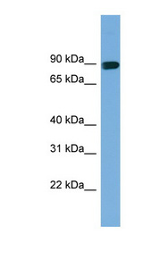 AFAP1 / AFAP Antibody - AFAP1 antibody Western blot of Fetal Liver lysate. This image was taken for the unconjugated form of this product. Other forms have not been tested.