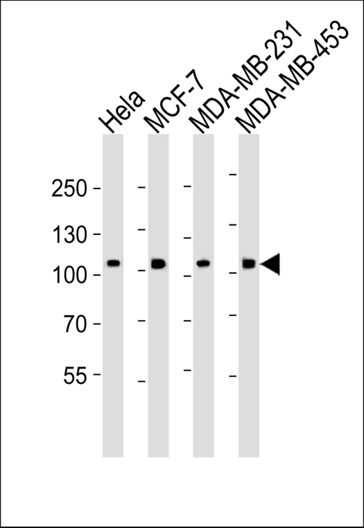 AFAP1 / AFAP Antibody - Western blot of lysates from HeLa, MCF-7, MDA-MB-231, MDA-MB-453 cell line (from left to right) with AFAP1-Y451. Antibody was diluted at 1:1000 at each lane. A goat anti-rabbit IgG H&L (HRP) at 1:5000 dilution was used as the secondary antibody. Lysates at 35 ug per lane.