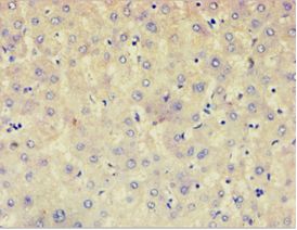 AFAP1 / AFAP Antibody - Immunohistochemistry of paraffin-embedded human liver using antibody at 1:100 dilution.
